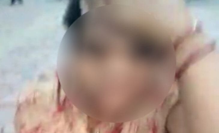 BSc student self fired in college, she was botherd with flittering of college profesor, damoh news