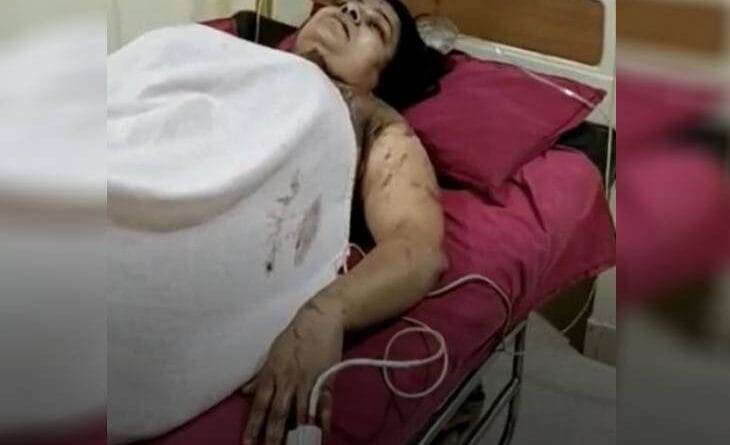 Beauty parlor operator did acid attack on lover's wife, bid- raped her by keeping her in live-in for 5 years, crime news, acid attack, gwalior news, rape with beauty parlor operator