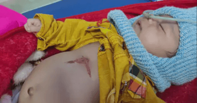 In Ujjain, a one and a half month old baby was branded with a hot rod, used a trick to cure pneumonia; admitted to hospital, ujjain, kalluram news, crime, child admit in hospital