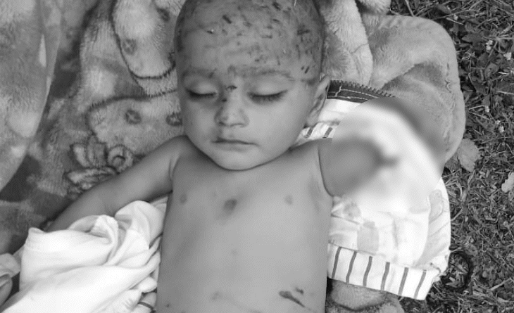 In Bhopal, a 7 month old innocent boy was killed by dogs, dragged away and ate his hands, bhopal, child dead with dog bite, kalluram news, bhopal