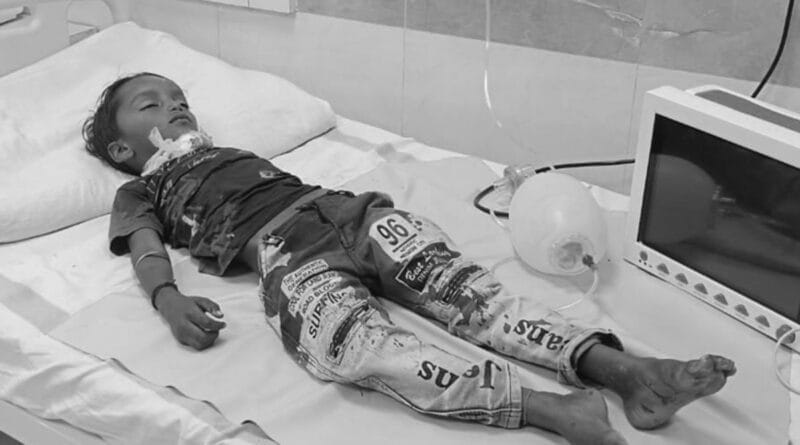 7 year old child died due to throat slit due to China door, family members kept the dead body and blocked the road, dhar, china Manjhe, kalluram news