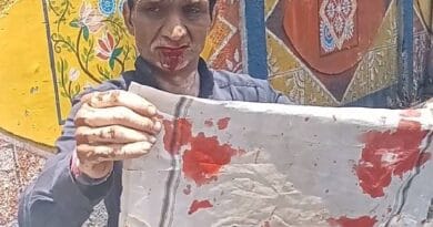 हेलमेट नहीं लगाने पर ट्रैफिक पुलिस ने मुंह में मारा डंडा, निकला खून; जबलपुर में शिकायत के बाद जांच के आदेश  4 Traffic police hit him with stick in mouth for not wearing helmet, blood came out; Order for investigation after complaint in Jabalpur, Jabalpur, Kalluram News, Today Updates, Crime