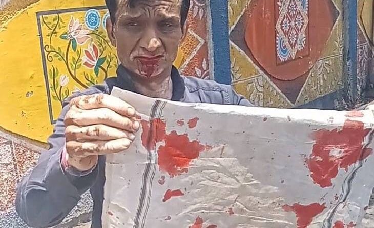 Traffic police hit him with stick in mouth for not wearing helmet, blood came out; Order for investigation after complaint in Jabalpur, Jabalpur, Kalluram News, Today Updates, Crime