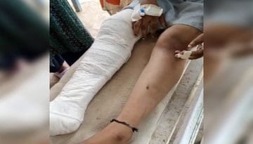 ग्वालियर में छेड़छाड़ का विरोध करने पर 7वीं की छात्रा को पीटा, पैर फ्रैक्चर, प्राइवेट पार्ट में डाला डंडा  3 7th class student beaten up, leg fractured, stick inserted in private part for protesting against molestation in Gwalior, Gwalior, Kalluram News, Today Updates, Crime