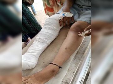 7th class student beaten up, leg fractured, stick inserted in private part for protesting against molestation in Gwalior, Gwalior, Kalluram News, Today Updates, Crime