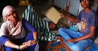 गुना में 5 साल के बेटे ने बिस्तर पर पेशाब किया, सौतेली मां गरम पलटे से दागा, बोली- जितना रोएगा, उतना जलाऊंगी  4 In Guna 5 year old son urinated on the bed, step mother hit him with hot iron, said - the more he cries, the more I will burn him, Kalluram News, Today Updates, Crime, Guna