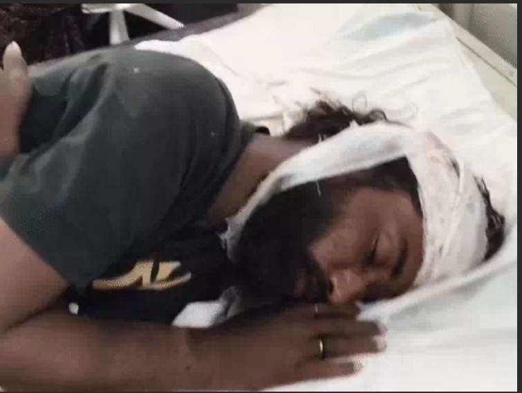 शिवपुरी में लोगों ने युवक को सड़क पर पटका, मारे लात–घूंसे और डंडा, पुलिस का सायरन सुन भागे आरोपी 2 In Shivpuri people threw a young man on the road cruely