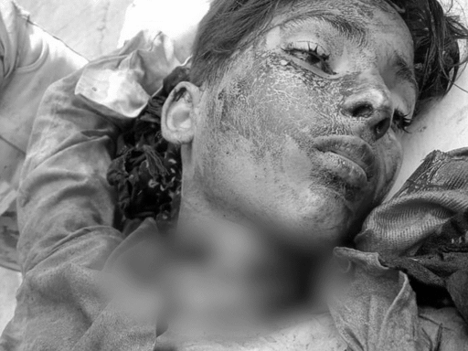 चाइनीज मांझे से कटी 8वीं के छात्र की गर्दन, मौत; इंदौर में बाइक से घर जाते समय हादसा 2 An 8th-grade student died after his neck was cut by Chinese thread