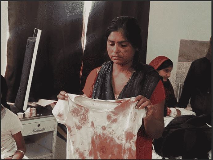 8-year-old girl fights dog to save younger brother In Rajgarh